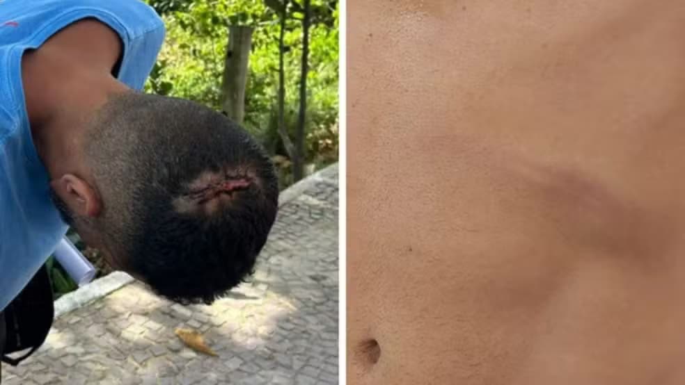 Turista Relata Agressão Violenta em Praia Capixaba